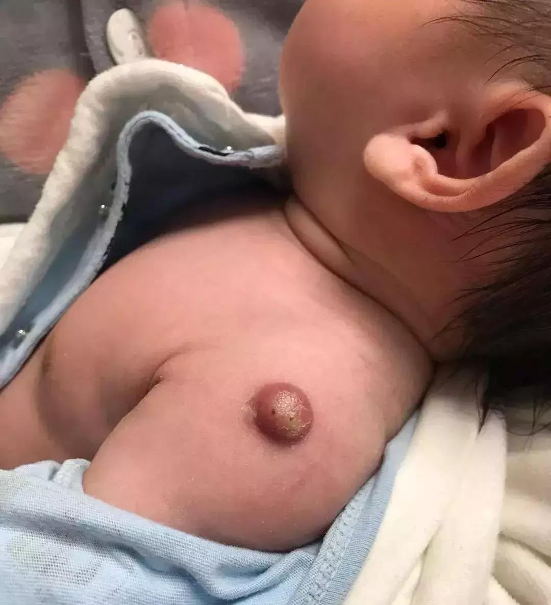 女子用假避孕套后染病:人心究竟能坏到什么程度?!