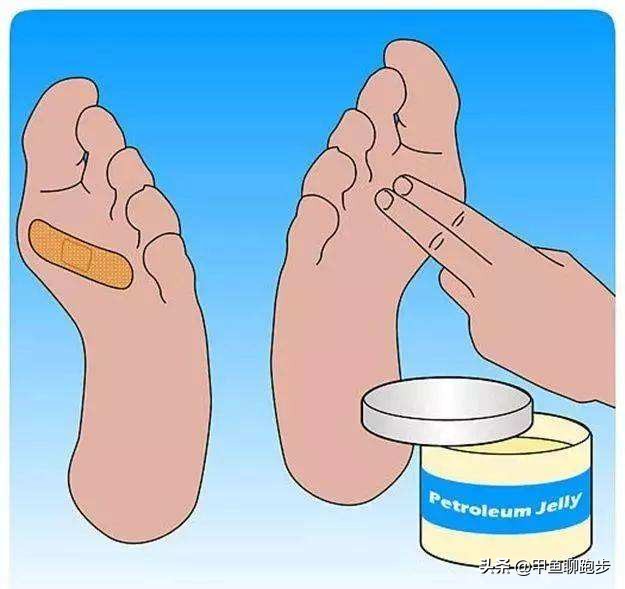跑步脚起水泡然后破了怎么处理,跑步脚起水泡擦什么药