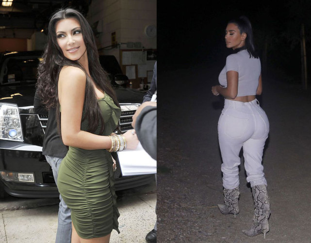 美国整形手术,整形医生提醒