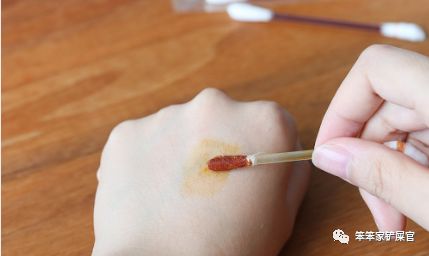 被猫抓了怎么办？：与其担心狂犬病，不如先处理伤口，避免猫爪热