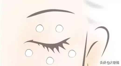 脸上有好多脂肪颗粒怎么办,脸上长脂肪粒的原因和解决方法