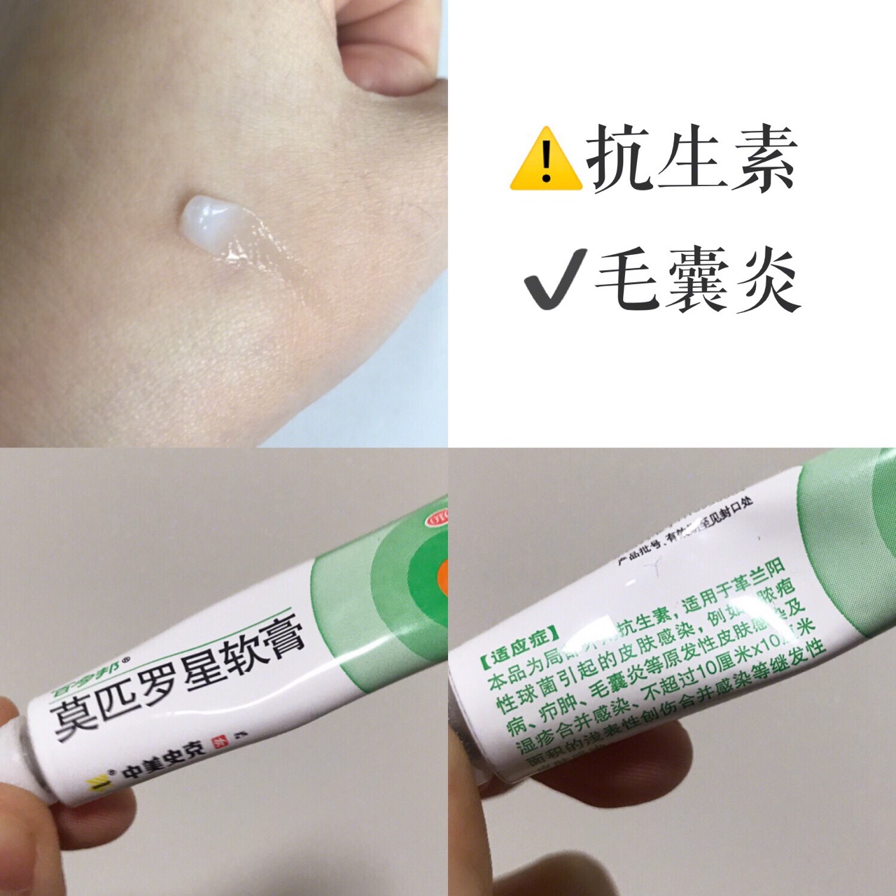 网上卖的十大祛痘药,女孩子必用的祛痘神器