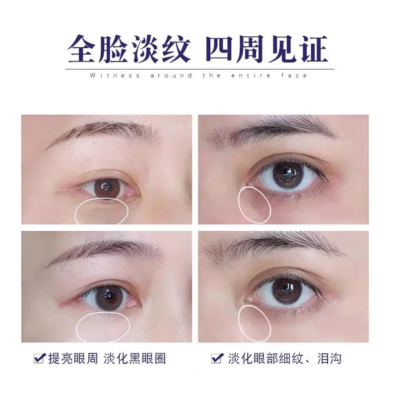 欧莱雅紫熨斗眼霜玻色因含量,欧莱雅紫熨斗眼霜的真实测评