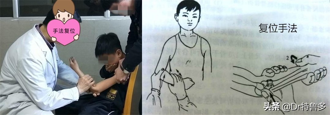 宝宝胳膊拽了一下疼怎么办,宝宝胳膊一拽响