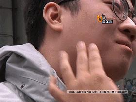 打完瘦脸针青蛙腮正常吗,打完瘦脸出现青蛙腮