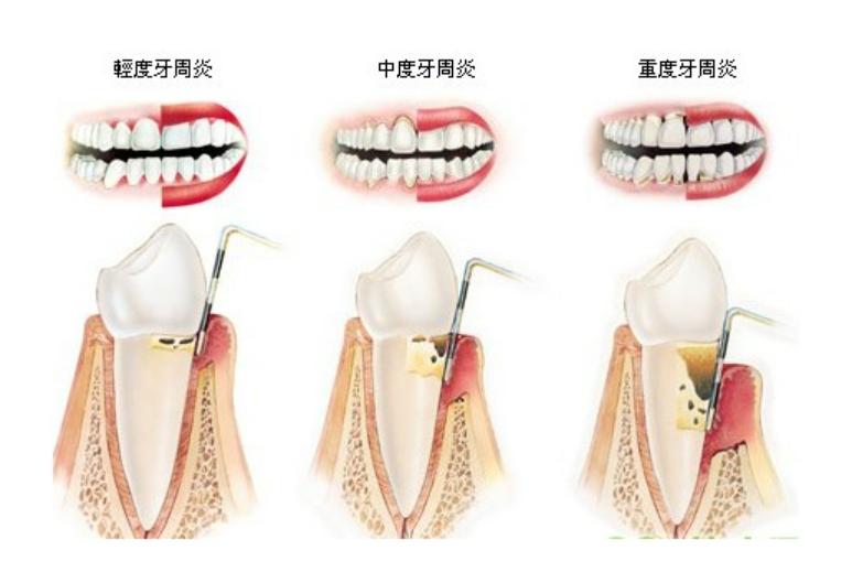 电动牙刷2023推荐平价,电动牙刷推荐2023年