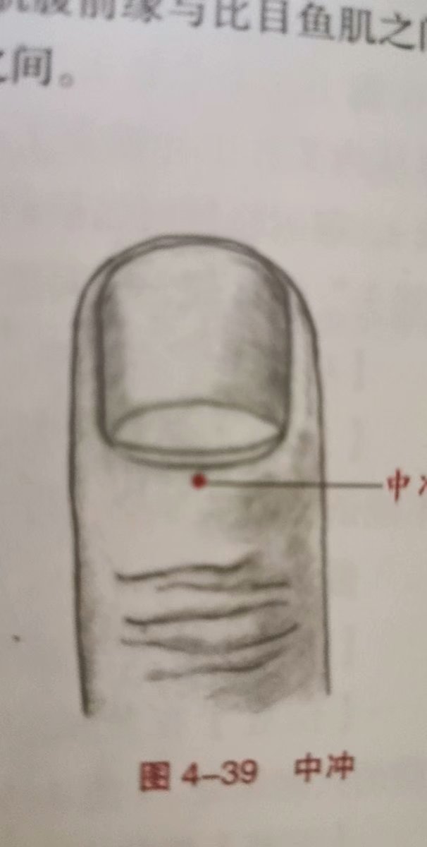 中冲穴讲解,心包穴正确位置
