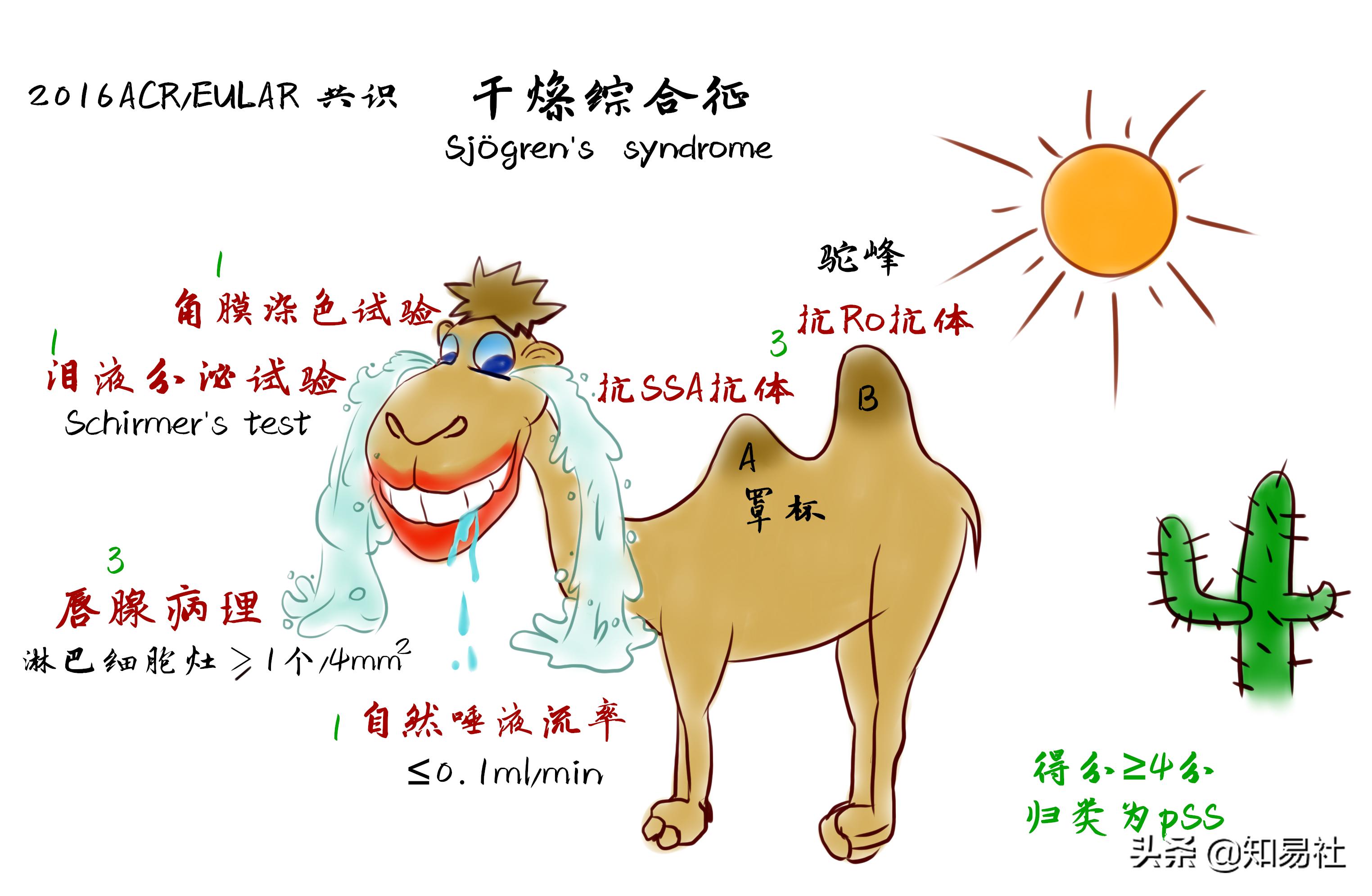医学漫画视频|眼干、口干不是小事，小心干燥综合征