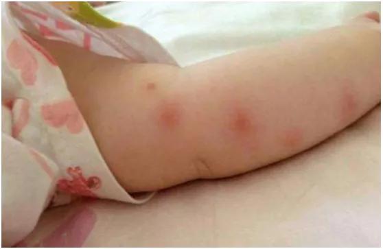 日本驱蚊产品怎么样,日本驱蚊产品