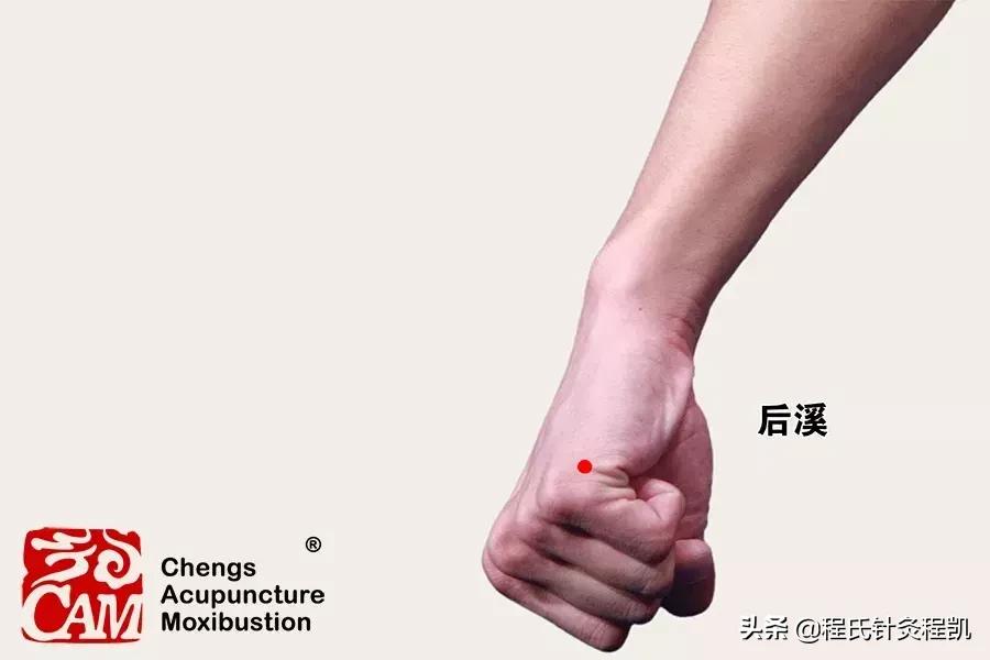 急性腰扭伤按哪个穴位图解,马立强手法治疗急性腰扭伤