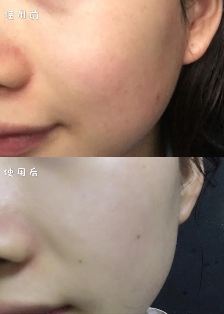 邓伦代言的面膜，在屈臣氏月销10万＋，网友：补水美白修复还便宜