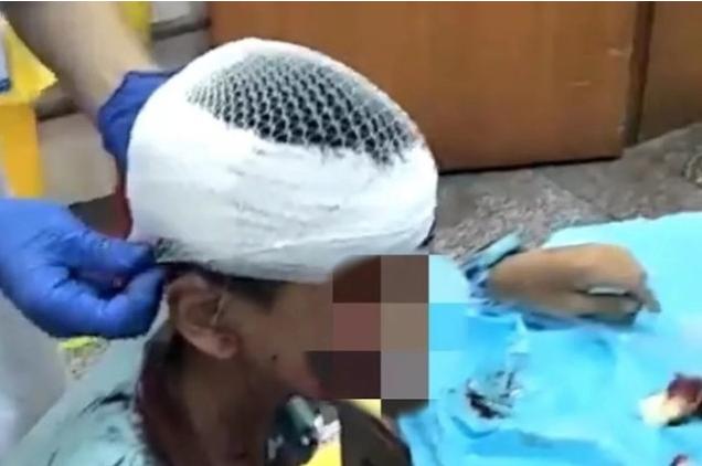 一旦被狗咬伤正确的做法,遇到狗伤人事件个人处理流程