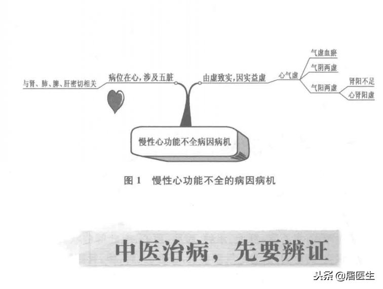 一穴一方一法治慢性心功能不全·使用方便、取效快、疗效好
