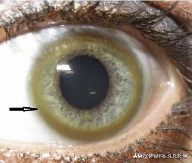 眼球人体解剖学讲解,眼睛解剖讲解