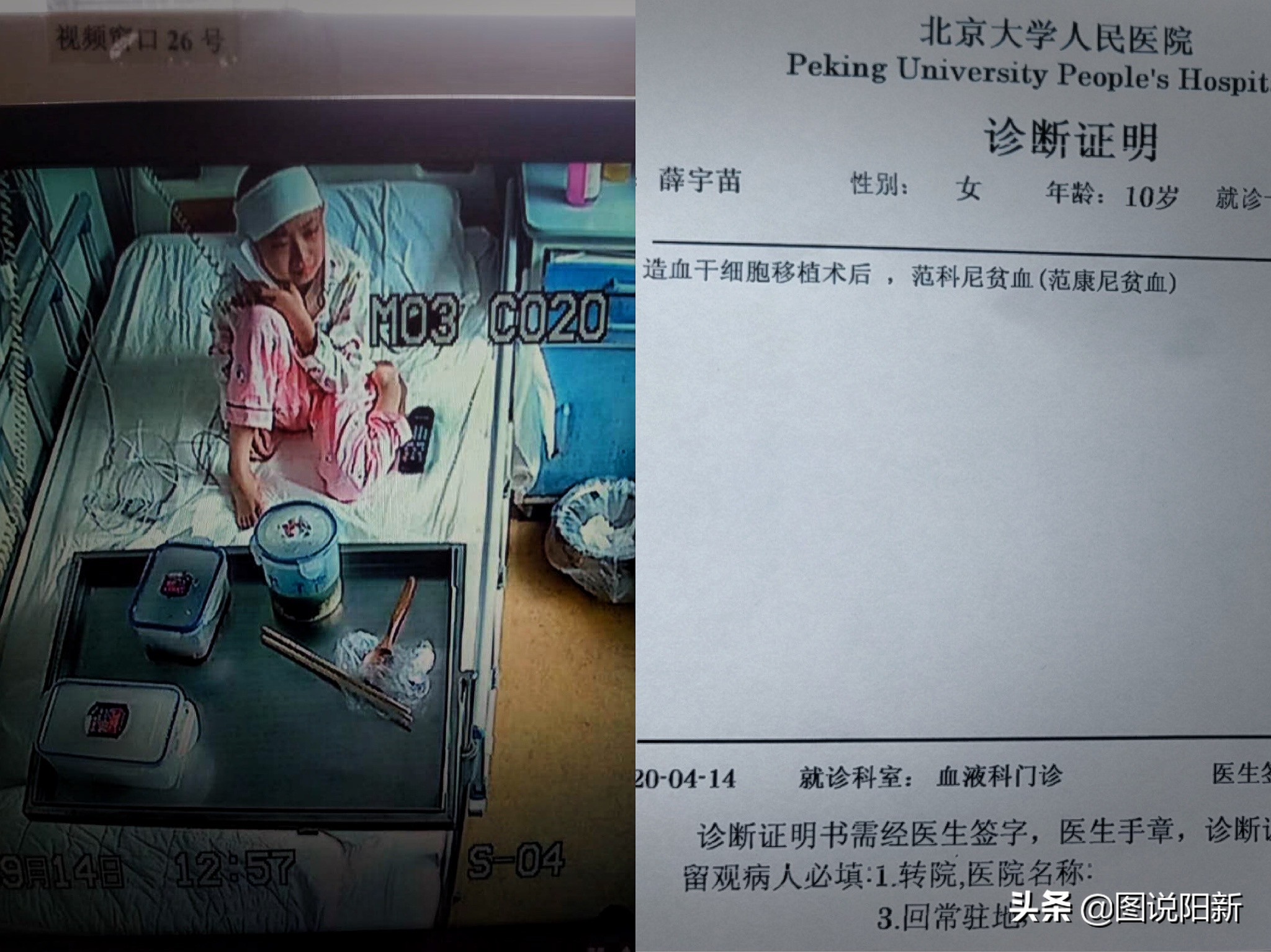 女孩患了200万分之一罕见病,女孩身患罕见怪病