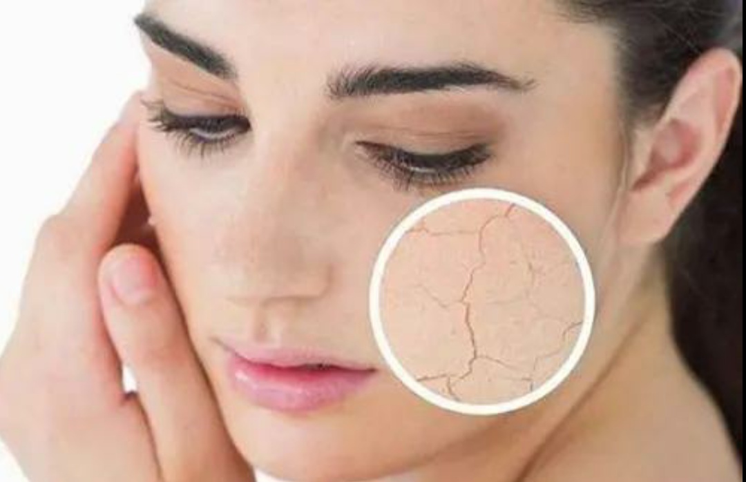 嘴唇干燥综合症怎么治,干燥综合征容易出现哪些口腔症状