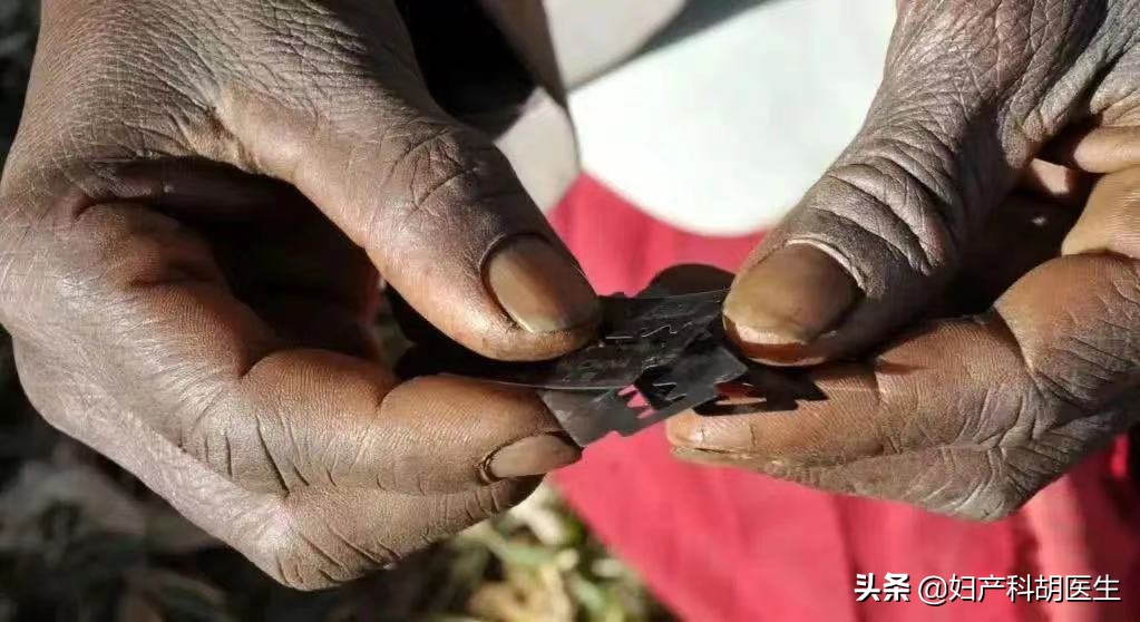 为了变美我把外阴切除了,为了美丽