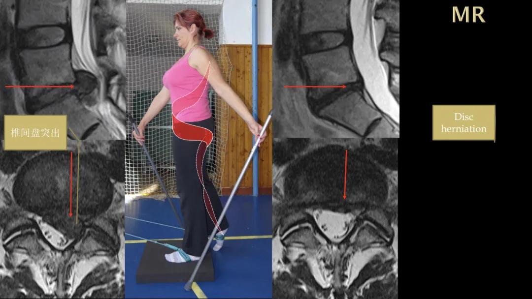 sps鍒涘浜虹悊鏌ュ痉,鐞嗘煡寰蜂翰鎺坰ps瀵煎笀