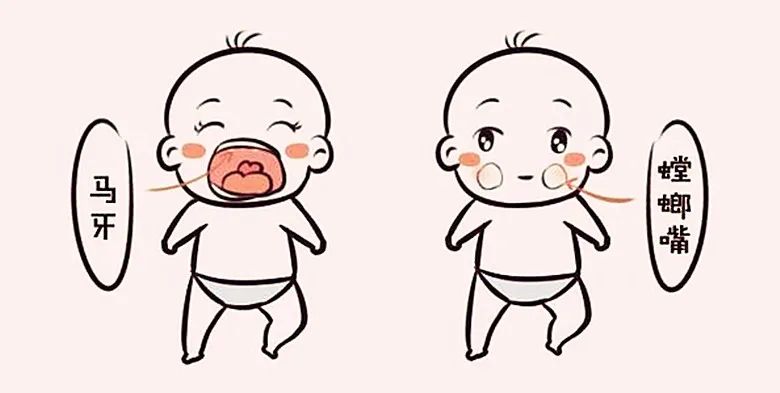 新生儿马牙子和黄疸有关系吗,初生婴儿马牙怎么护理