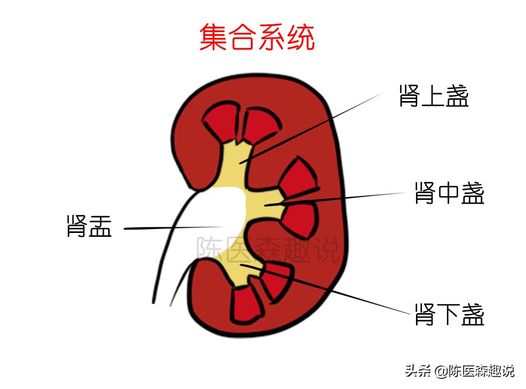1.5厘米的肾结石保守治疗能排石吗,肾结石快速排石方法