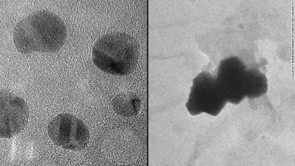 惊了！CNN公布最新研究：雾霾可以入脑，导致老年痴呆……