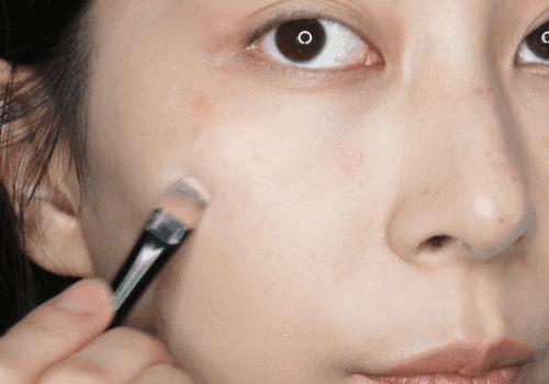 脸上的斑可以通过医美去掉吗,脸上长斑了能用激光去除吗