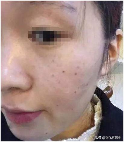 经常吃哪些食物能淡黄褐斑,黑褐斑的克星食物