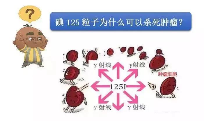 肿瘤康复神器,治疗肿瘤先进核技术