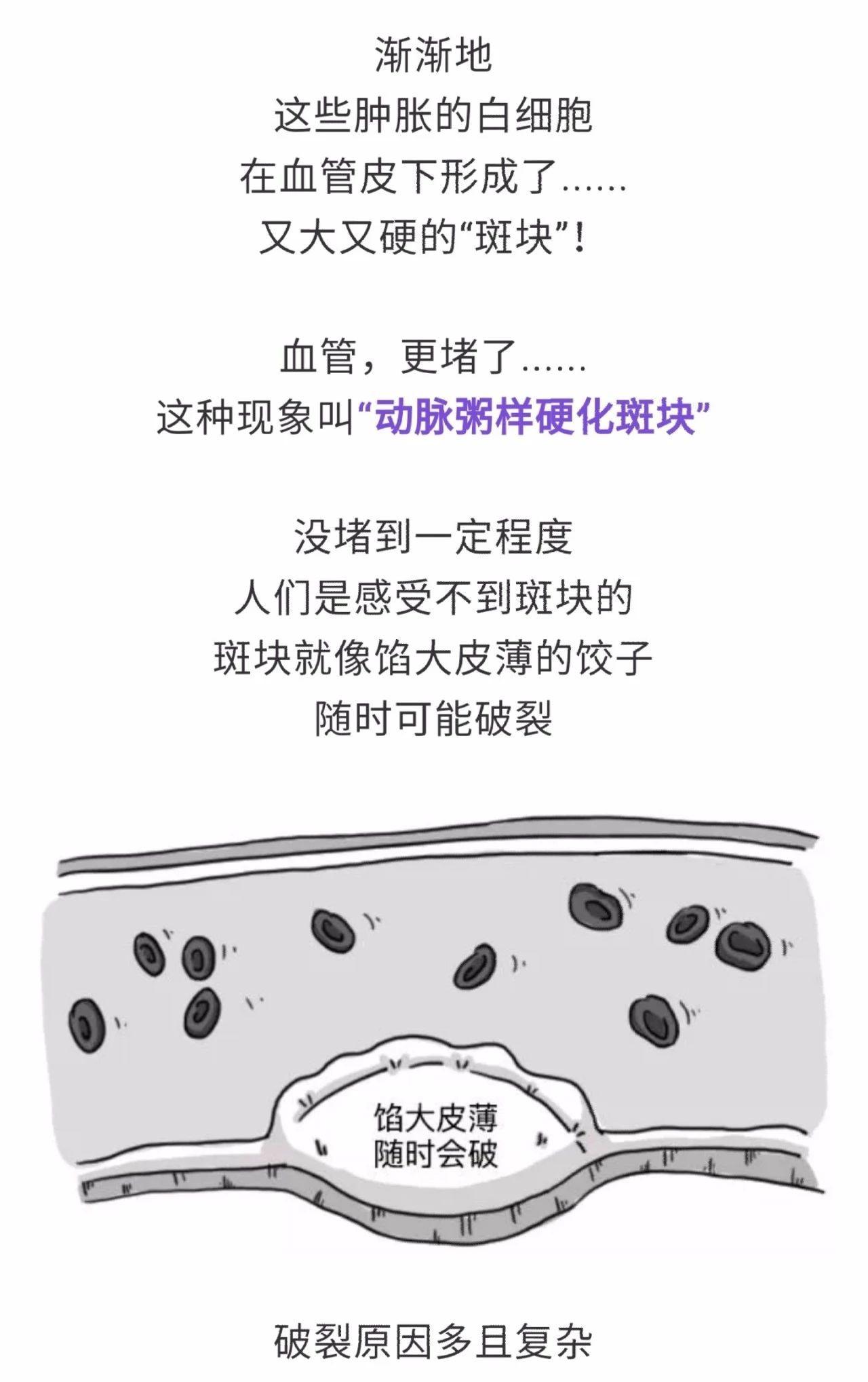 「民间偏方奇效方」高脂血症