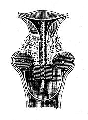 近距离放疗的副作用,近距离放疗