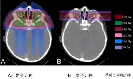头部肿瘤质子放疗长期毒副作用,质子放疗对什么肿瘤效果不明显