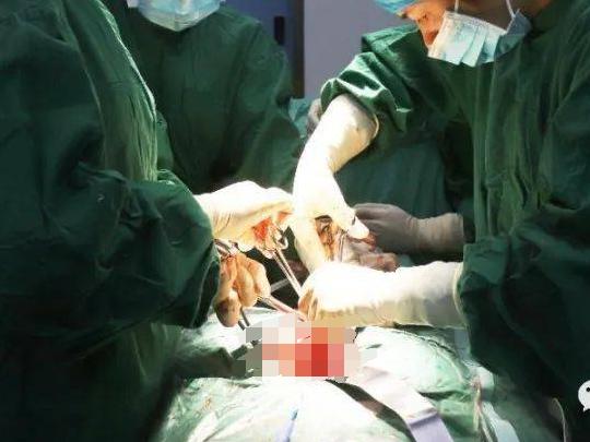 子宫肌瘤手术有哪些注意事项,子宫肌瘤手术需要注意什么