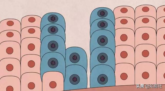 羞羞后警惕HPV感染，一不小心会得宫颈癌