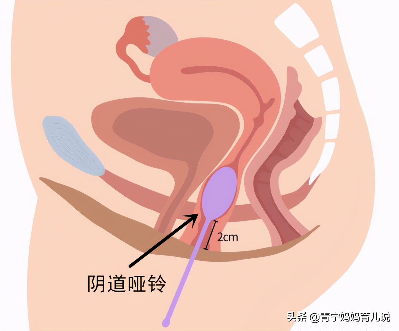 宝妈盆底肌修复最简单动作,产后修复盆底肌宝妈