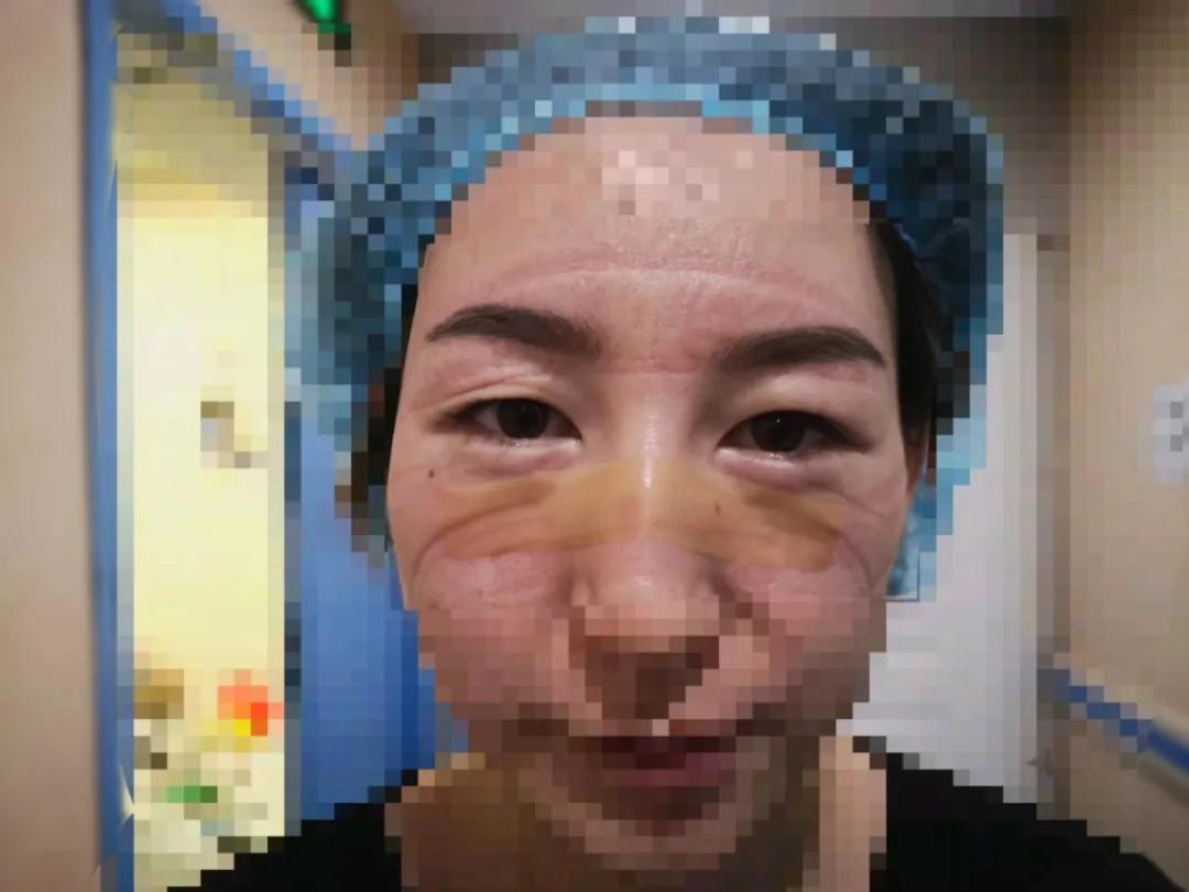 医院病人进icu活下去的几率多少,95后姑娘进icu抢救26小时