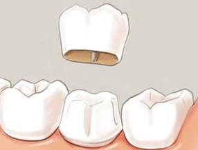 4种原因需警惕,哪些因素影响牙体色彩变化