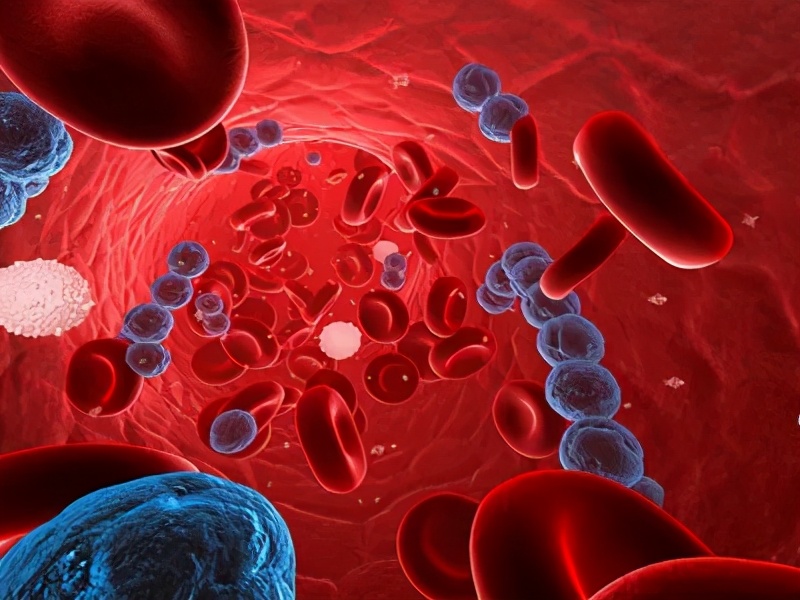 crrt在脓毒症中的作用,脓毒症的治疗