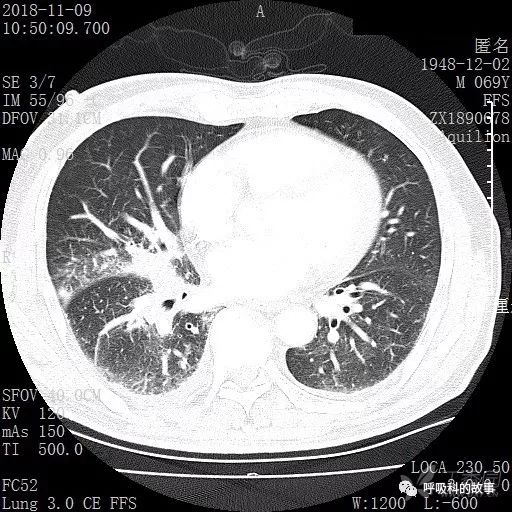 怎么应用统计学做调查,统计学方法可以解决的主要问题
