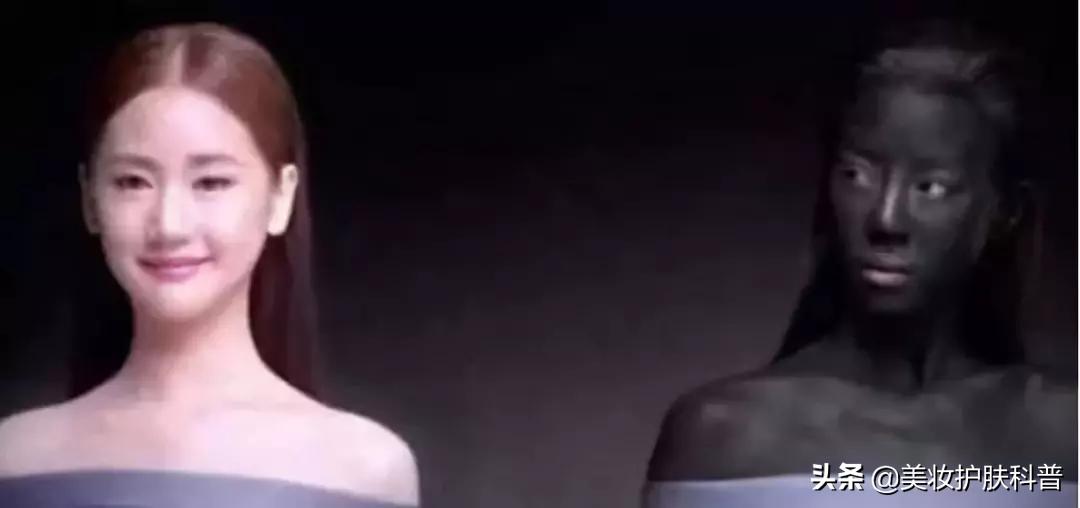 毛孔粗大怎么办最有效收缩毛孔,毛孔粗大收缩毛孔最快有效的方法