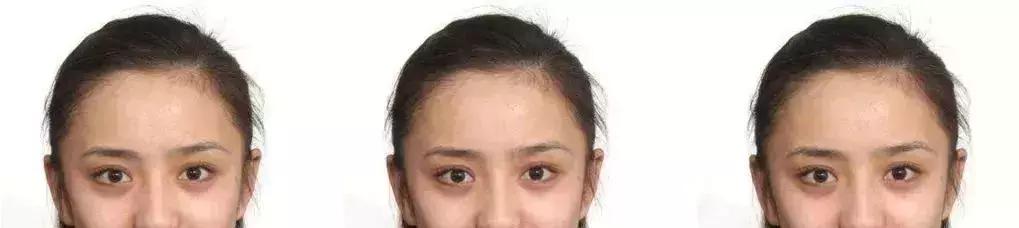 戚薇颜值巅峰到底有多高,戚薇现在为什么那么显老