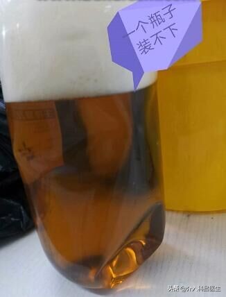 中医治疗巧克力囊肿新进展,巧克力囊肿的最新医疗成果