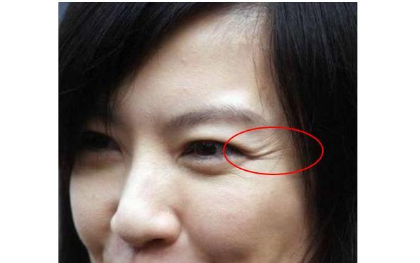 经常敷面膜有什么改善,经常敷面膜皮肤看起来还是很差