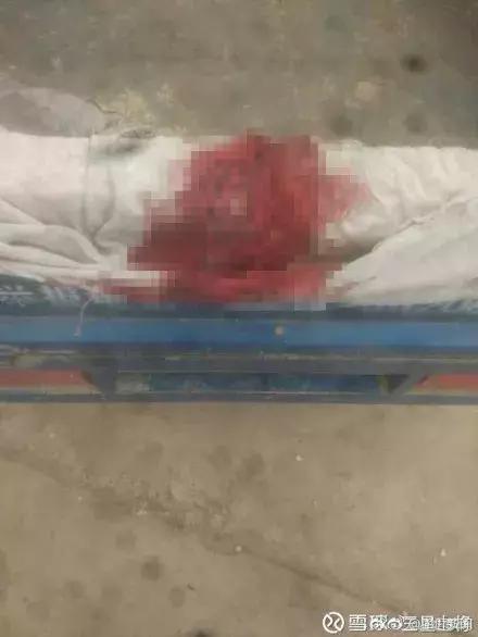 甘肃8岁女孩疑在校被打*体下**出血，警方介入