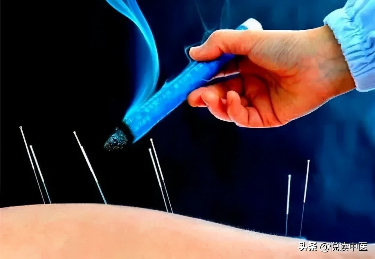 国外治疗膜性肾病,中西医结合治疗肾病的优势