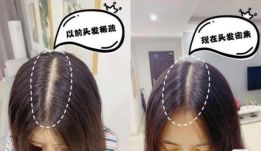 90后怎么防脱 (90后该如何防脱)