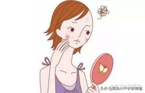 不要再做的医美项目,淡痘印产品推荐见效快