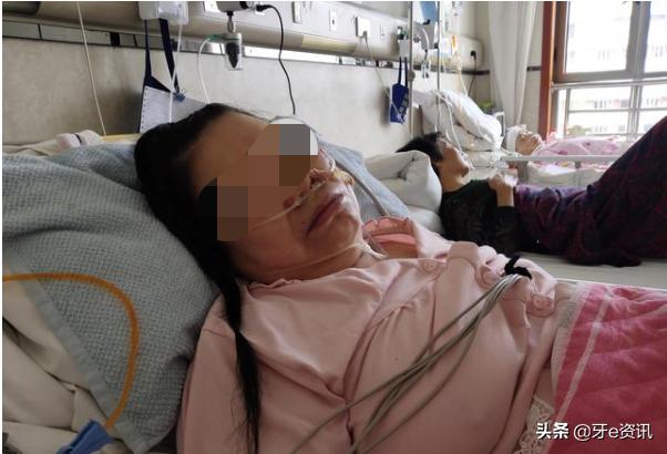 环湖医院穿刺治疗脑干出血,脑干出血3ml后脑水肿会有几天