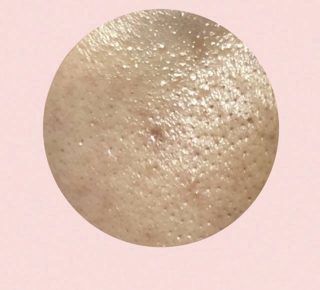 油皮毛孔大泛红怎么改善,干皮毛孔粗大怎么改善小妙招