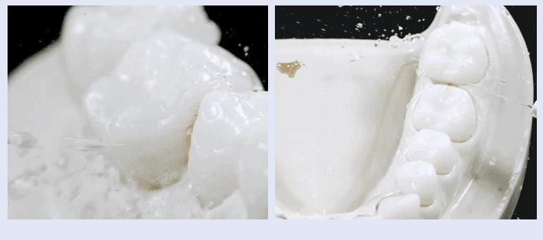 牙科诊所里你不知道的事,口腔医生提醒