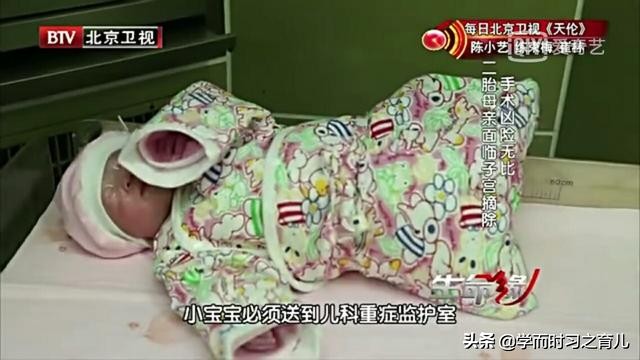 怀孕爸爸需要知道的事,怀孕初期能看出前置胎盘吗